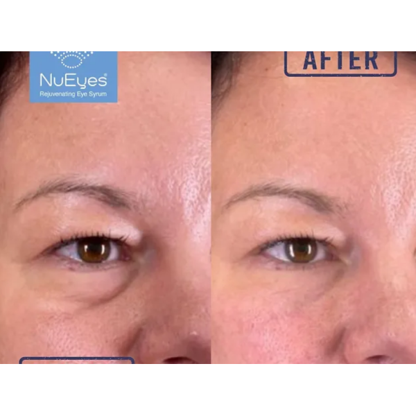 NuEyes and NuRejuv Beauty Bundle - Image 2